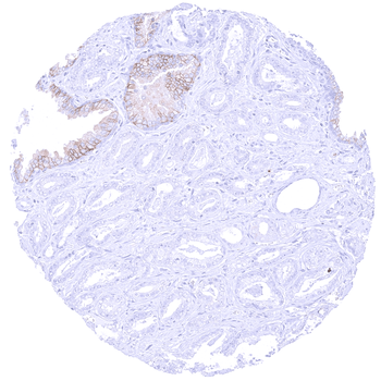 CD38 antibody