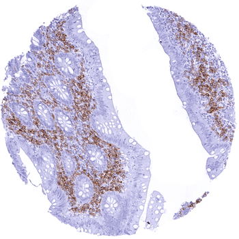 CD38 antibody