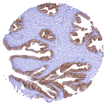 CD38 antibody