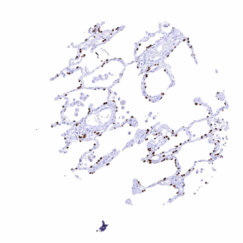 TTF-1 / Thyroid Transcription Factor 1 / NKX2-1 antibody