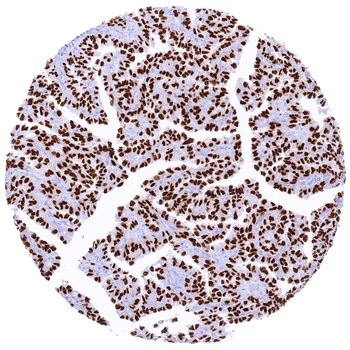 TTF-1 / Thyroid Transcription Factor 1 / NKX2-1 antibody