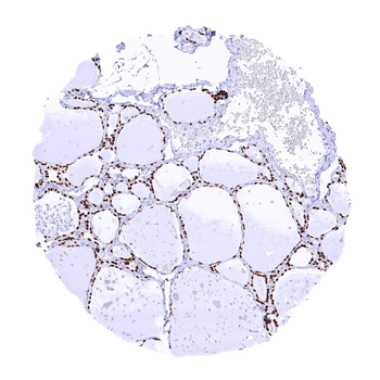 TTF-1 / Thyroid Transcription Factor 1 / NKX2-1 antibody