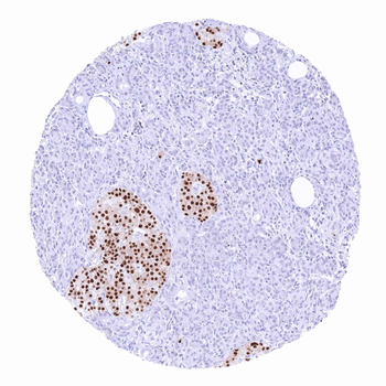 PAX6 antibody