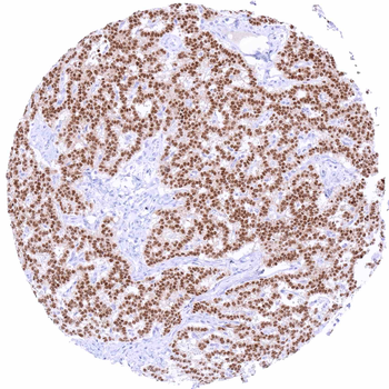 PAX6 antibody