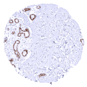 TRPS1 antibody