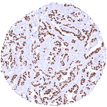 TRPS1 antibody