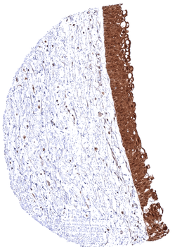 MTAP antibody