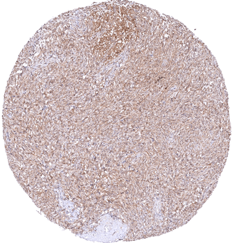 MTAP antibody