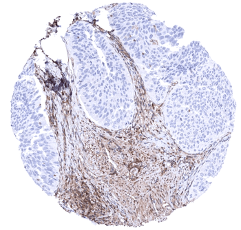 MTAP antibody