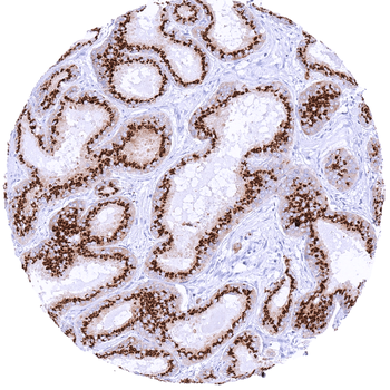 Prostein antibody (MSVA-460R)