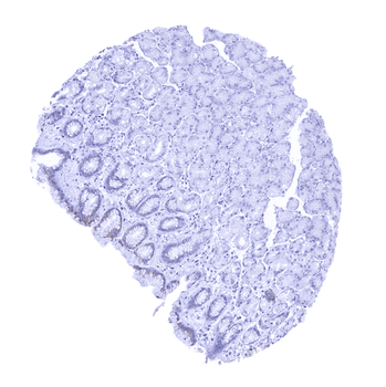 Prostein antibody (MSVA-460R)