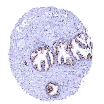 Prostein antibody