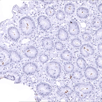 Helicobacter Pylori antibody