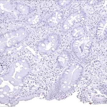 Helicobacter Pylori antibody