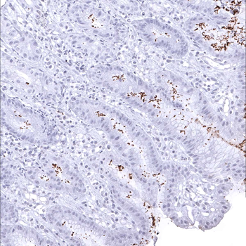 Helicobacter Pylori antibody