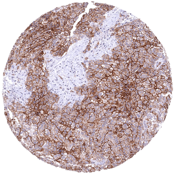 CD141 antibody
