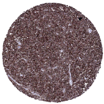 CD23 antibody
