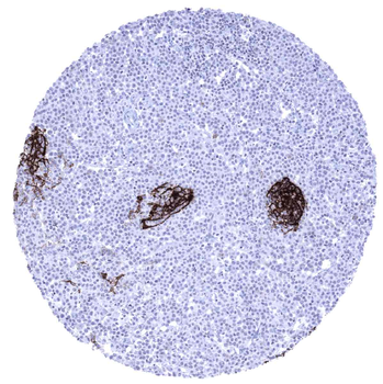CD23 antibody