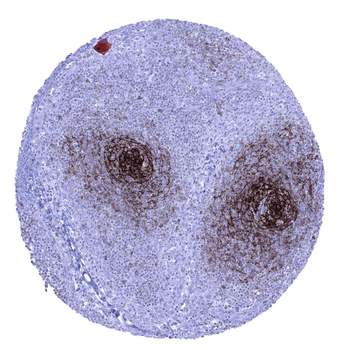 CD23 antibody