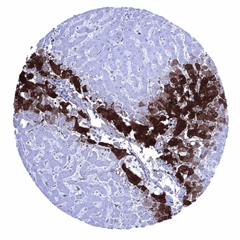 Glutamine Synthetase antibody