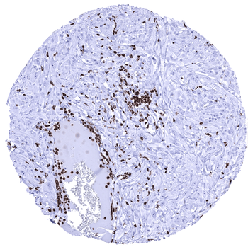 Myeloperoxidase / MPO antibody (MSVA-692M)