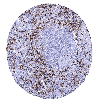 Myeloperoxidase / MPO antibody (MSVA-692M)