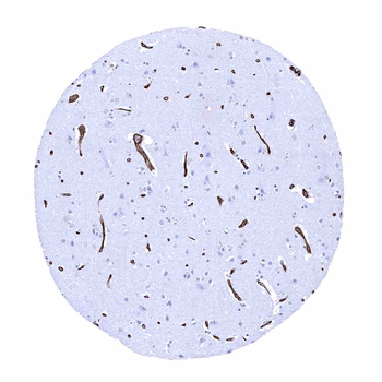 GLUT1 antibody