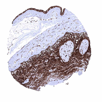 GLUT1 antibody