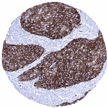 GLUT1 antibody