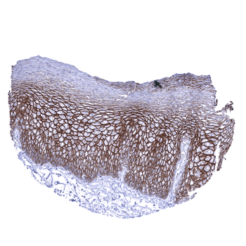 Desmoglein 3 antibody