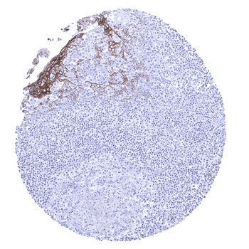 Desmoglein 3 antibody (MSVA-543M)