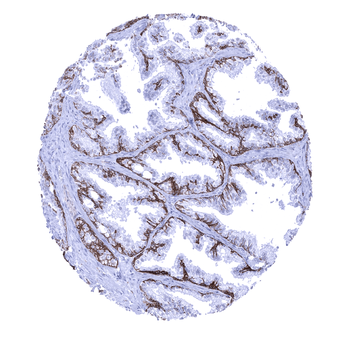 TRIM29 antibody (MSVA-629M)