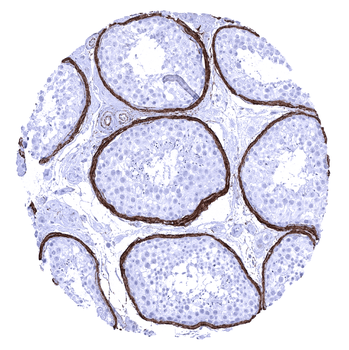 Elastin antibody