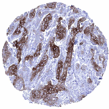 Desmoglein 1 antibody (MSVA-544M)