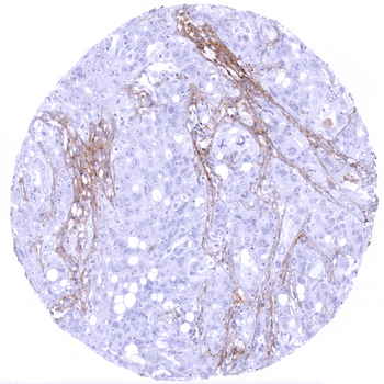 Decorin antibody