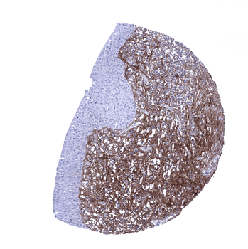 Decorin antibody