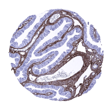 Decorin antibody