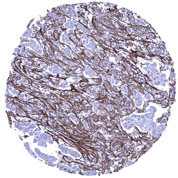 Periostin antibody