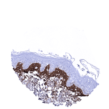 Periostin antibody