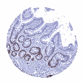 SOX9 antibody