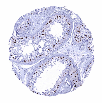 SOX9 antibody