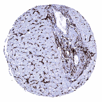 HLA-DRB1 antibody