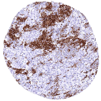 HLA-DRB1 antibody