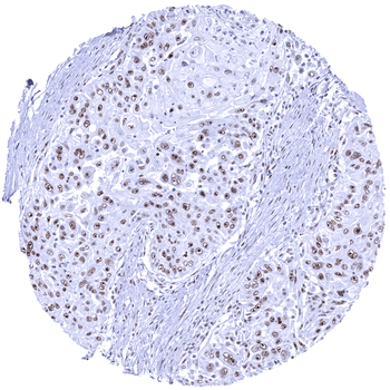 Nucleolin antibody
