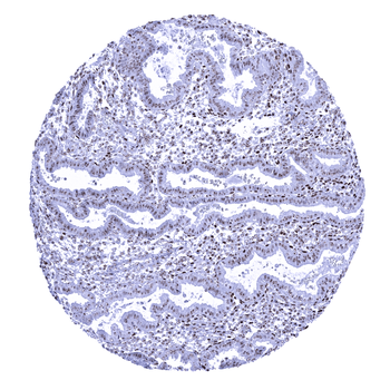 Nucleolin antibody