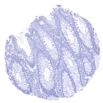 Calbindin 1 antibody (MSVA-471M)