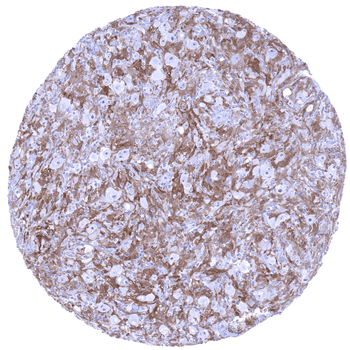 Factor XIII alpha antibody (MSVA-813R)