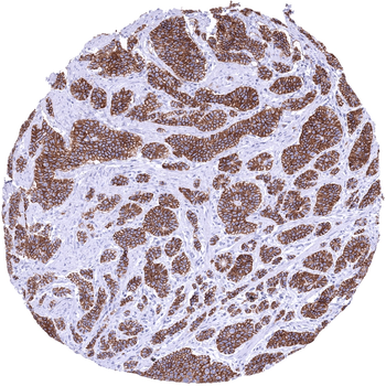 Cadherin 17 / CDH17 antibody (MSVA-517M)