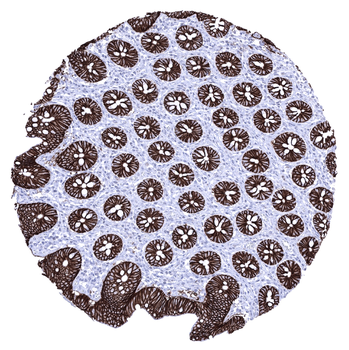 Cadherin 17 / CDH17 antibody (MSVA-517M)