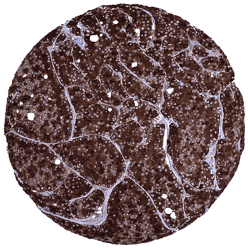 CELA3B antibody